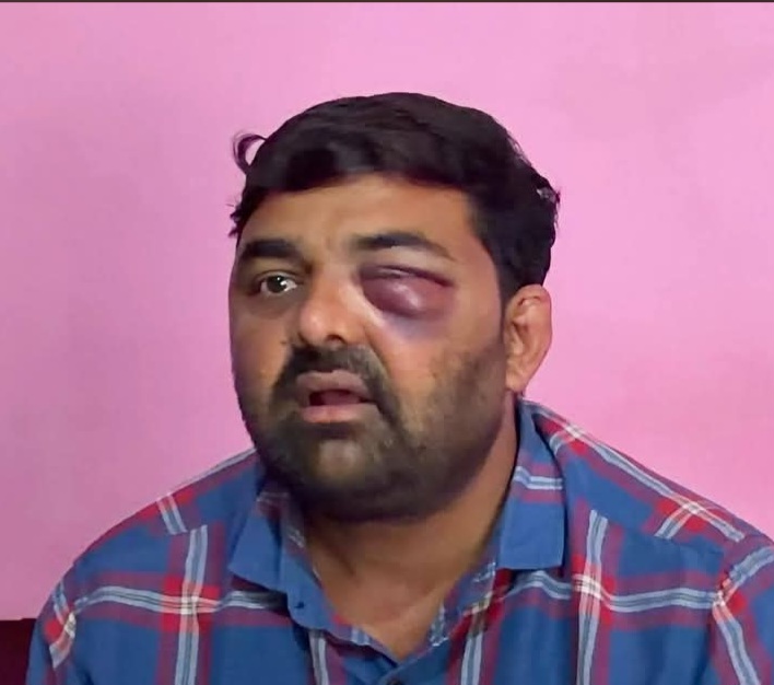 “बिग ब्रेकिंग” दिग्विजय भाटी और मोहित जाटव की पिटाई का आरोप “एसएससी अविनाश पांडे” ने अपने चेंबर में डेढ़ घंटे तक दलित नेता को पीटा।